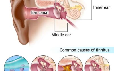 ENT (Ear, Nose & Throat): A Vital Specialty for Everyday Health